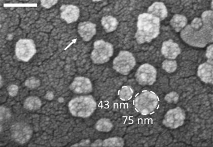 Exosomes samples - Electron micrograph of exosomes on a surface